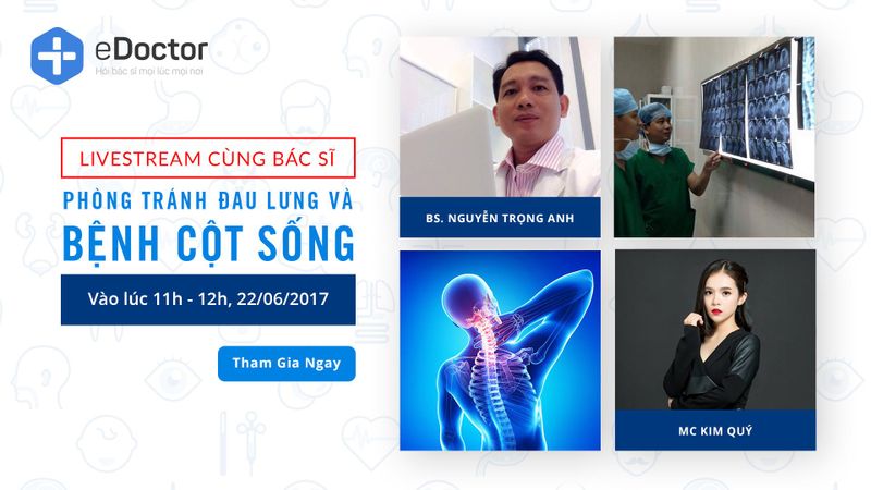 [Thông báo livestream] Phòng tránh đau lưng và bệnh cột sống