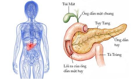 Dấu hiệu bất thường cảnh báo ung thư tuyến tụy