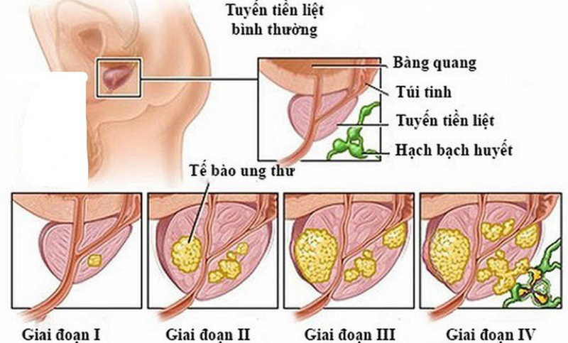 9 loại xét nghiệm đàn ông nào cũng cần làm