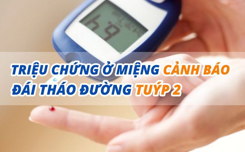 Triệu chứng ở miệng cảnh báo đái tháo đường tuýp 2