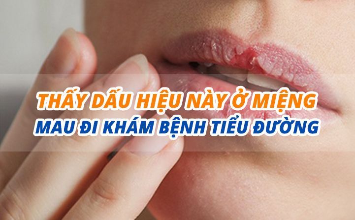 Thấy dấu hiệu này ở miệng, mau đi khám bệnh tiểu đường