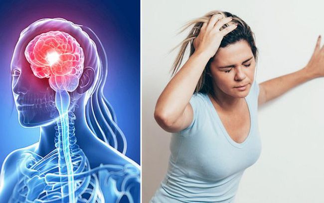 Chụp cộng hưởng từ (MRI) để tầm soát sớm tai biến mạch máu não