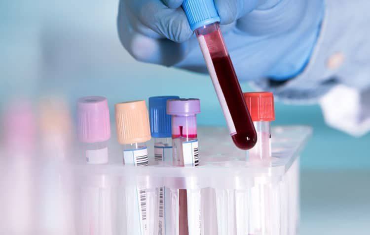 Bạn đã biết cách đọc những chỉ số xét nghiệm máu cơ bản này?