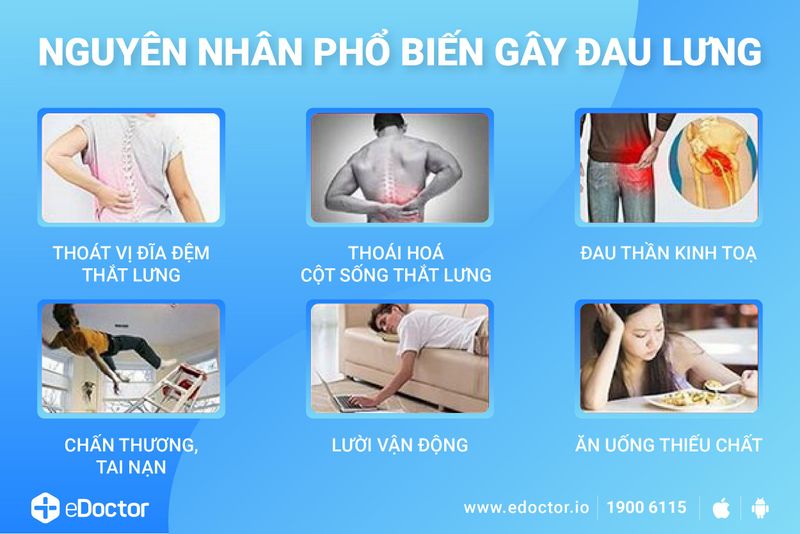 Vị trí đau lưng và chẩn đoán một số bệnh liên quan