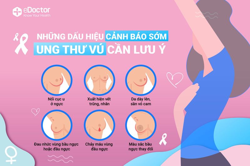 Những dấu hiệu cảnh báo ung thư vú sớm