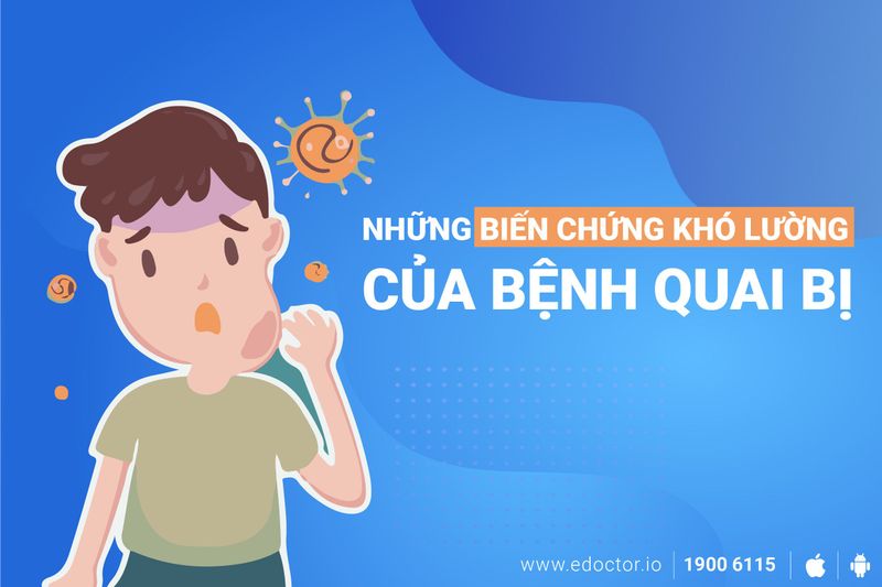 4 biến chứng khó lường của bệnh quai bị - đừng chủ quan