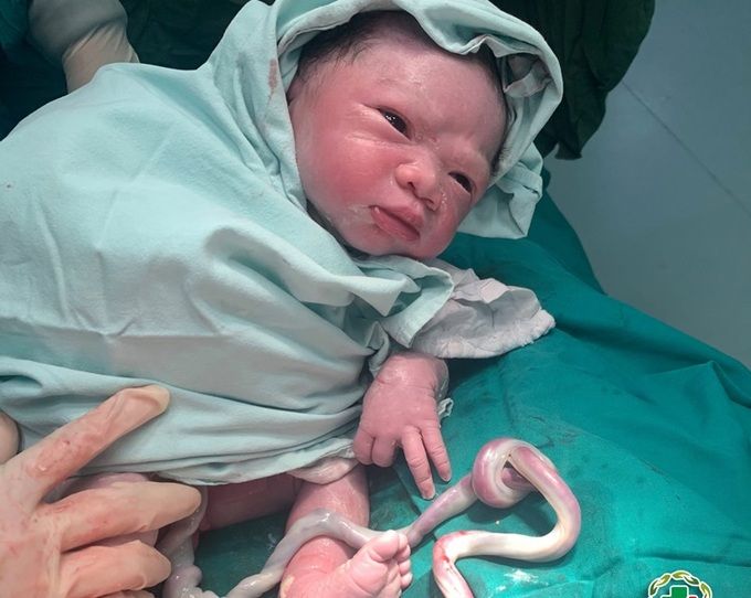 Bản tin sức khỏe 26/04/2021 - Phục hồi "bản lĩnh đàn ông" cho người bệnh mất dương vật do bỏng điện cao thế