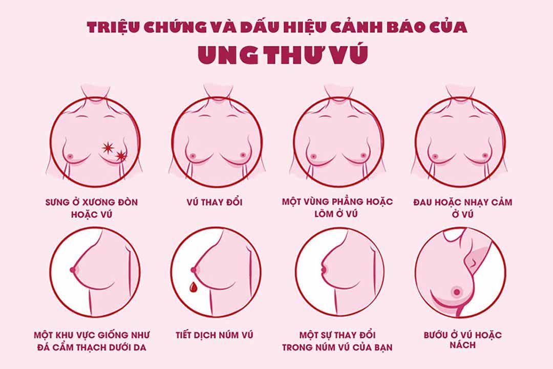 Cô gái 29 tuổi hối hận khi không tầm soát ung thư từ sớm