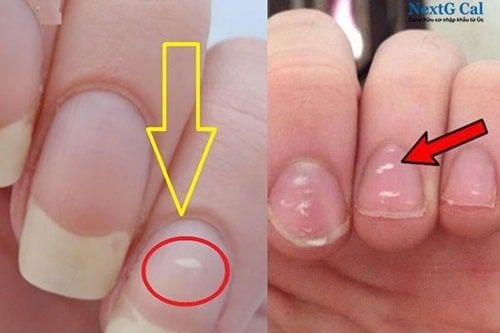 Cảnh giác với những tác hại không ngờ từ việc sơn móng tay