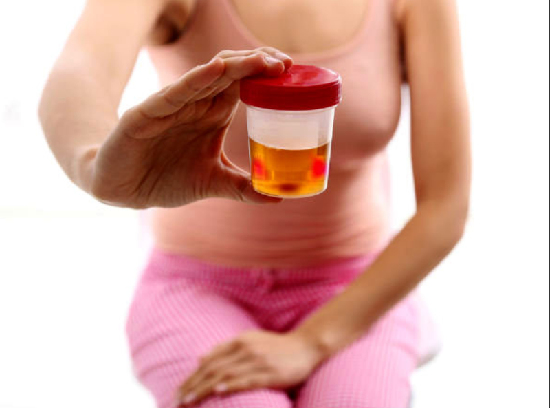 10 dấu hiệu nhận biết sớm của bệnh thận