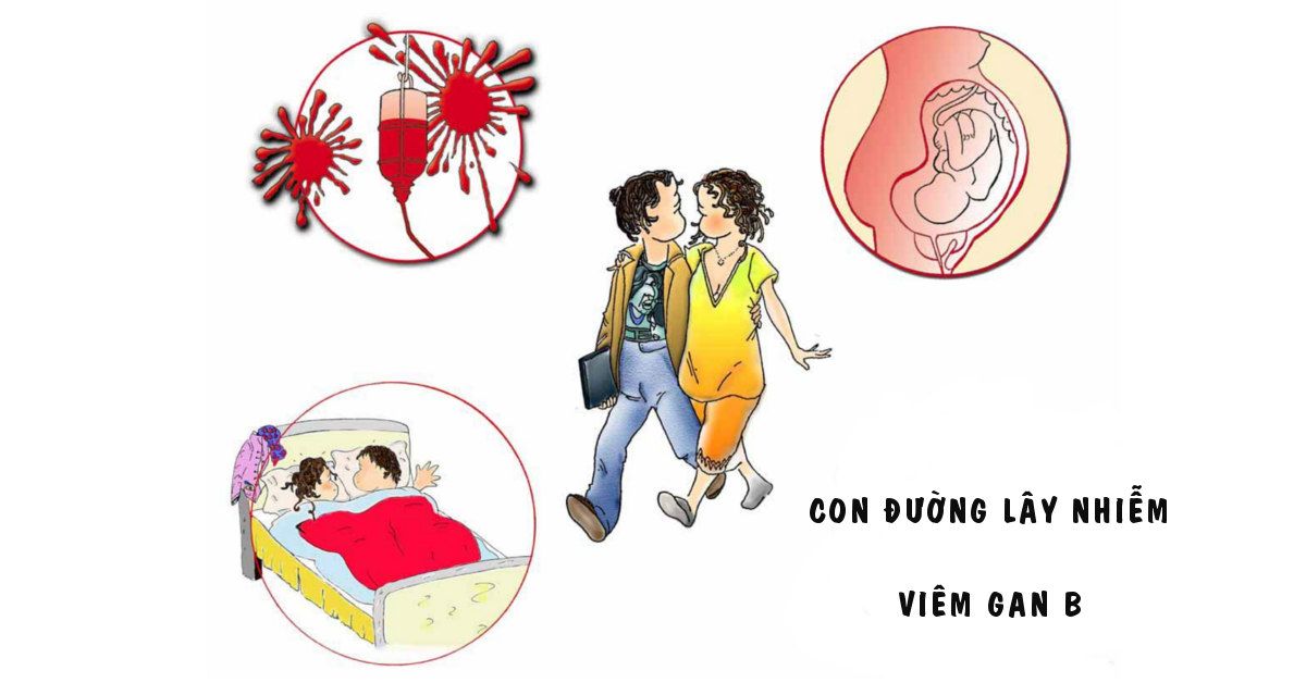 Viêm gan b lây qua đường nào ? có chữa được không ?