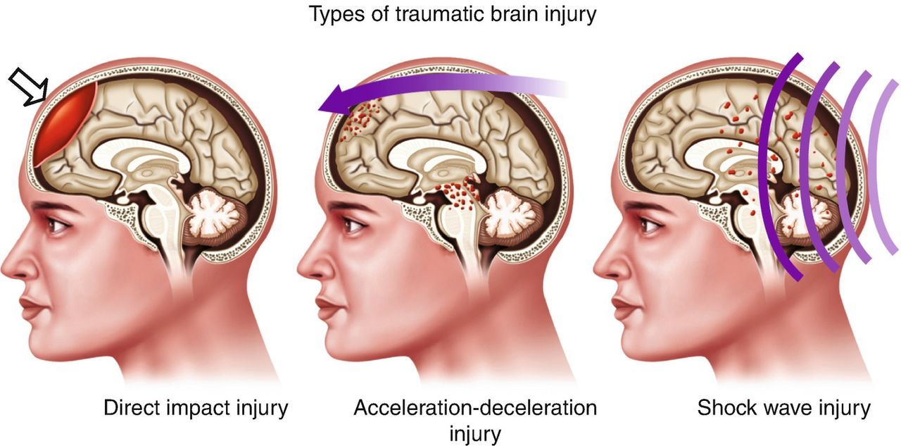 Hay quên ở giới trẻ là dấu hiệu của các bệnh mạn tính như gan, phổi, thận?