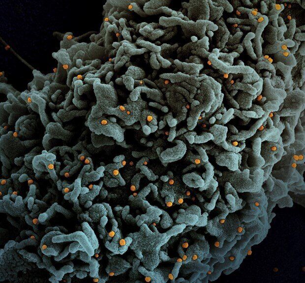 Sau Delta, biến thể Lambda lan rộng khắp nước Mỹ nguy hiểm như thế nào?