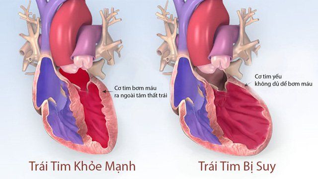 Uống đủ nước hàng ngày để tránh bệnh tim lúc về già