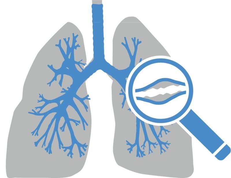 Ho có đờm xanh - Biểu hiện của 4 bệnh hô hấp nguy hiểm