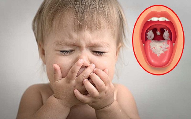 Vì sao cần tiêm nhắc lại vắc xin bạch hầu - ho gà - uốn ván ở trẻ? 