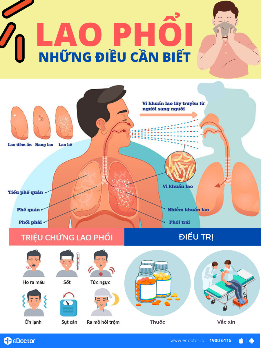 Triệu chứng lao phổi và những điều cần biết về bệnh lý