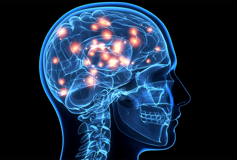 Đau đầu, mờ mắt coi chừng bị u sàn sọ não