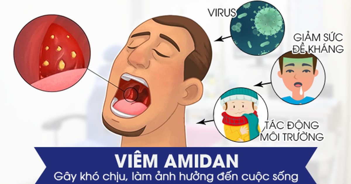 Khi nào cắt amidan cho trẻ và lưu ý chăm sóc sau khi cắt amidan 
