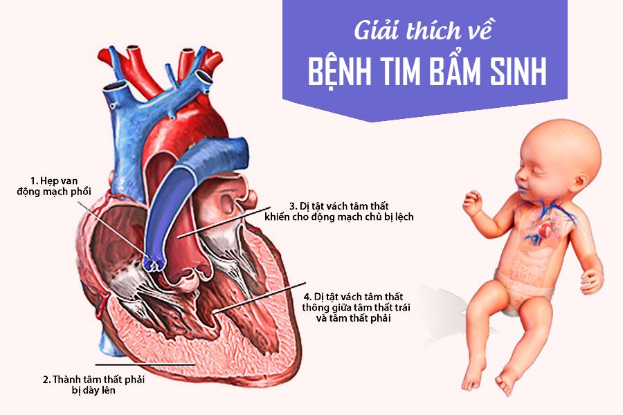 [CẢNH BÁO] Top 7 bệnh tim mạch ở việt nam có tỷ lệ mắc cao nhất 