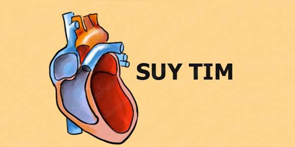 [CẢNH BÁO] Top 7 bệnh tim mạch ở việt nam có tỷ lệ mắc cao nhất 