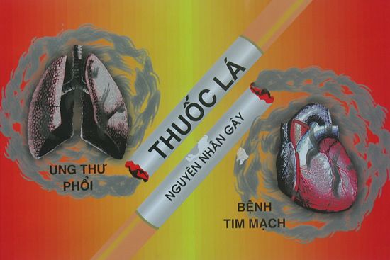 “Trẻ hóa” các bệnh tim mạch: Giới trẻ đang tự làm hại mình