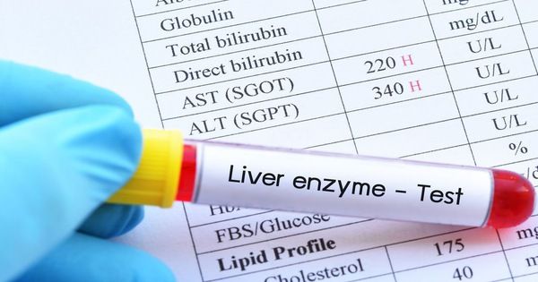 7 thói quen xấu khiến men gan tăng cao, dân văn phòng chú ý nhé! 