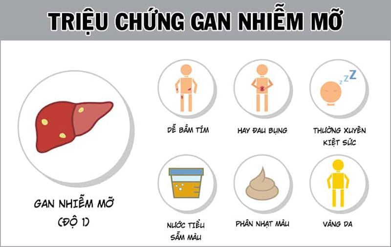 Gan nhiễm mỡ - căn bệnh thầm lặng ai cũng có thể mắc, phải tránh làm sao?