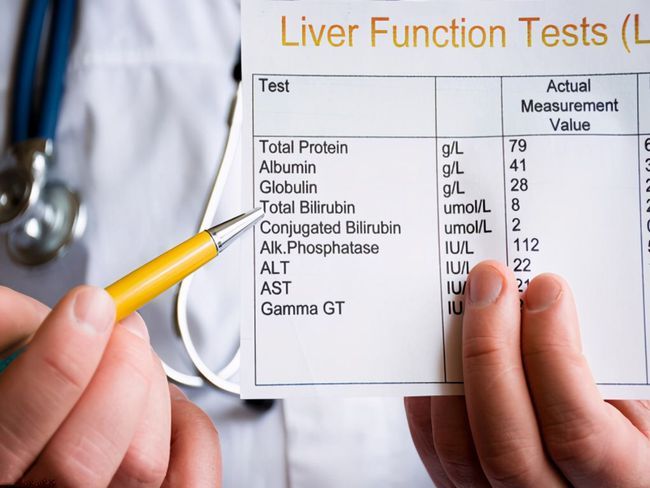 Những chỉ số xét nghiệm thường được bác sĩ chỉ định để kiểm tra chức năng gan mật - Lưu lại khi cần nhé!