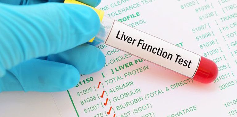 Những chỉ số xét nghiệm thường được bác sĩ chỉ định để kiểm tra chức năng gan mật - Lưu lại khi cần nhé!