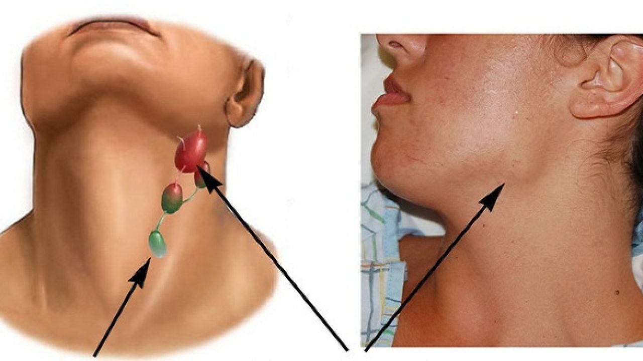 9 bệnh ung thư có tỷ lệ mắc cao nhất, đặc biệt là ở nam giới