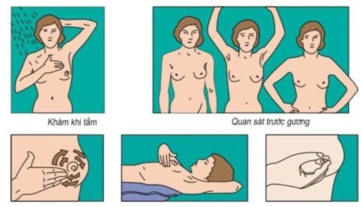 Chuyên gia mách cách phát hiện sớm bệnh ung thư tại nhà, kiểm tra ngay!