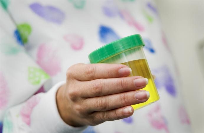 Những đối tượng nào cần làm kiểm tra chứng năng gan thận định kỳ?