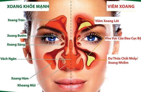 10 bệnh “thích” trời lạnh, lưu lại ngay để phòng ngừa nhé! 