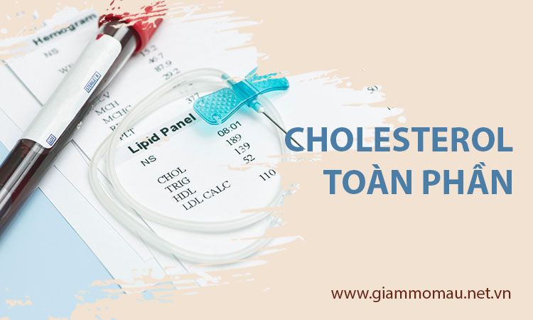 Những dấu hiệu phổ biến của bệnh mỡ máu và các chỉ số xét nghiệm cần làm để kiểm tra