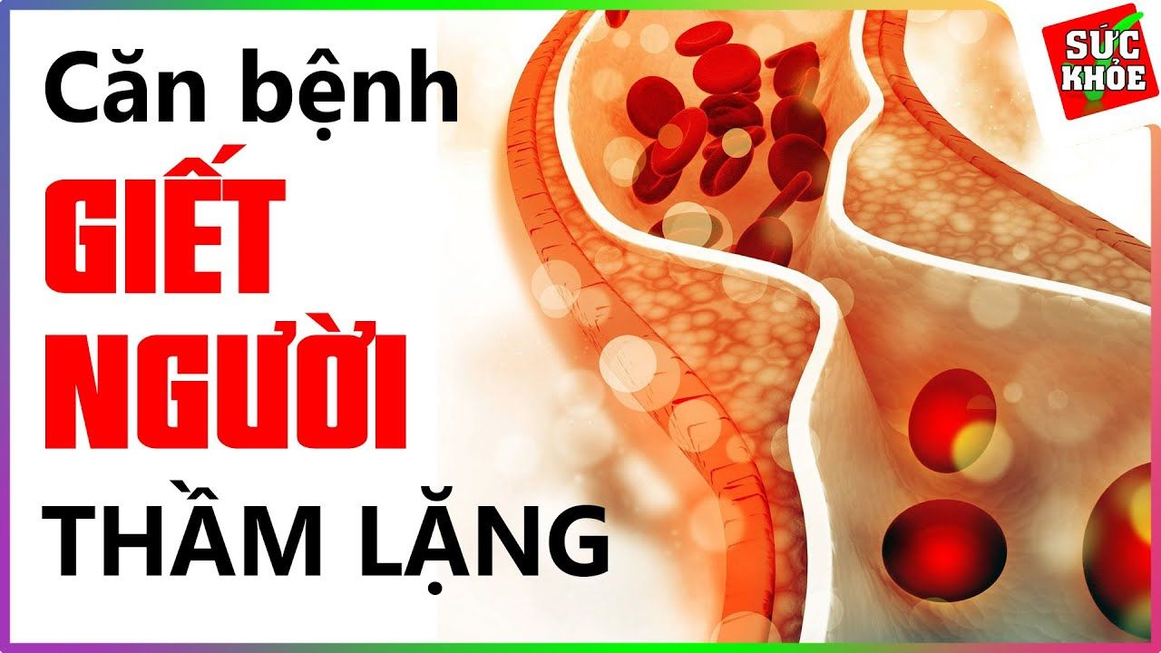 Mỡ máu cao gây tai biến: 4 cách giảm mỡ máu để ngừa rủi ro 