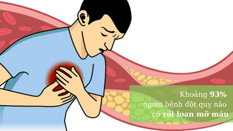 Mỡ máu cao gây tai biến: 4 cách giảm mỡ máu để ngừa rủi ro 