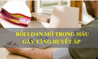 Mỡ máu cao gây nguy hiểm như thế nào cho sức khỏe? 6 tác hại cần cảnh giác