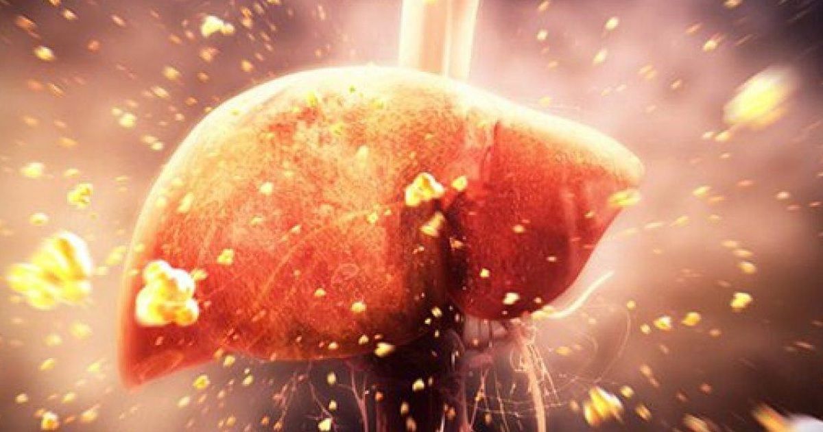 Điểm mặt 8 nguyên nhân phổ biến khiến men gan tăng cao cần kiểm tra ngay