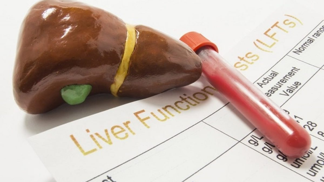Top 10 cách hạ men gan tại nhà hiệu quả, lưu lại và áp dụng ngay