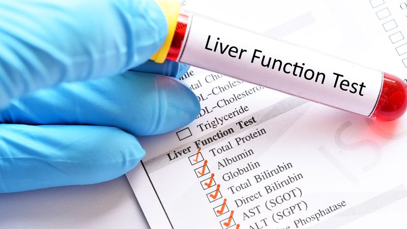 Hướng dẫn đọc kết quả các chỉ số xét nghiệm chức năng gan cơ bản 