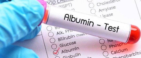 Hướng dẫn đọc kết quả các chỉ số xét nghiệm chức năng gan cơ bản 