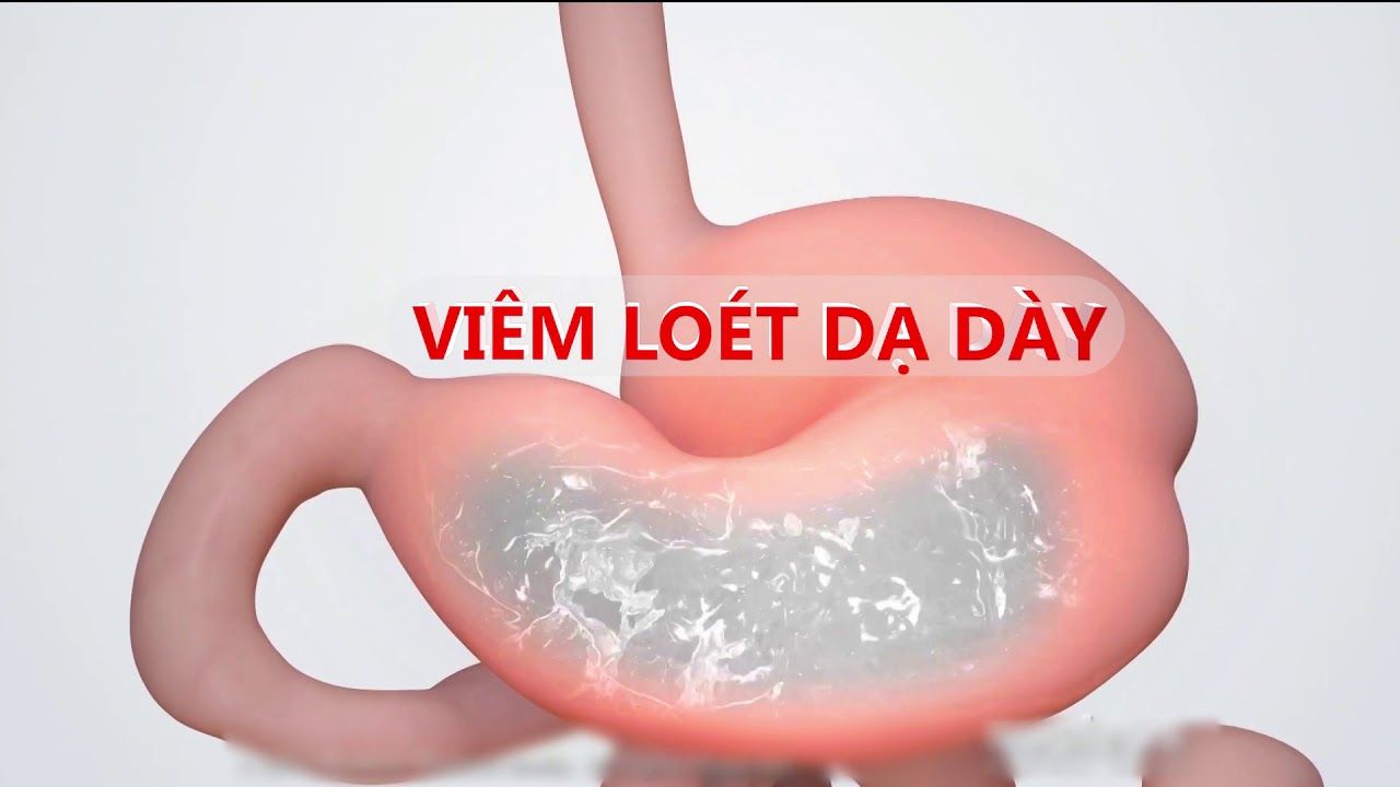 5 nhóm bệnh cần đặc biệt chú ý ăn uống ngày Tết 