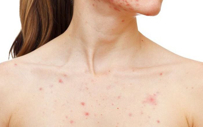 Hướng dẫn chăm lo sức khỏe sau Tết cho bạn và gia đình 