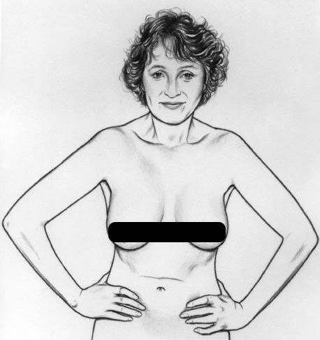 5 động tác nhìn, sờ, nắn vòng 1 kiểm tra ung thư vú