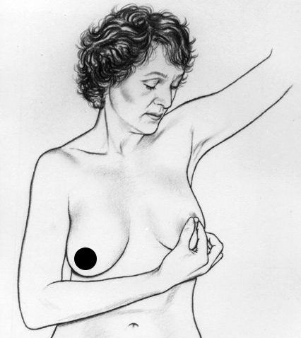 5 động tác nhìn, sờ, nắn vòng 1 kiểm tra ung thư vú