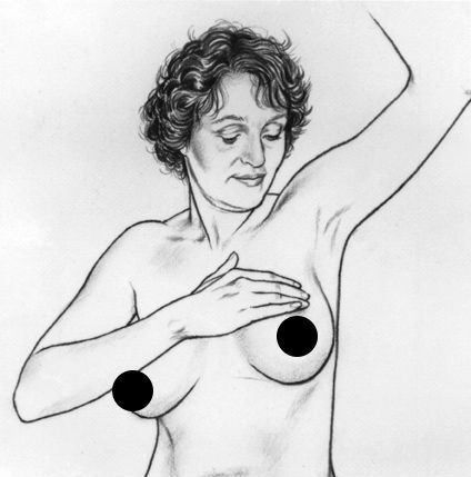 5 động tác nhìn, sờ, nắn vòng 1 kiểm tra ung thư vú