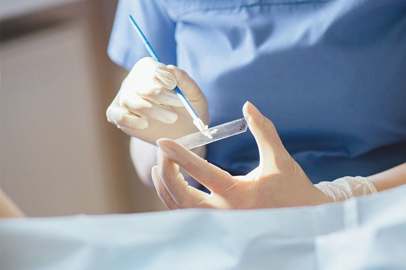 6 phương pháp xét nghiệm ung thư vú phổ biến