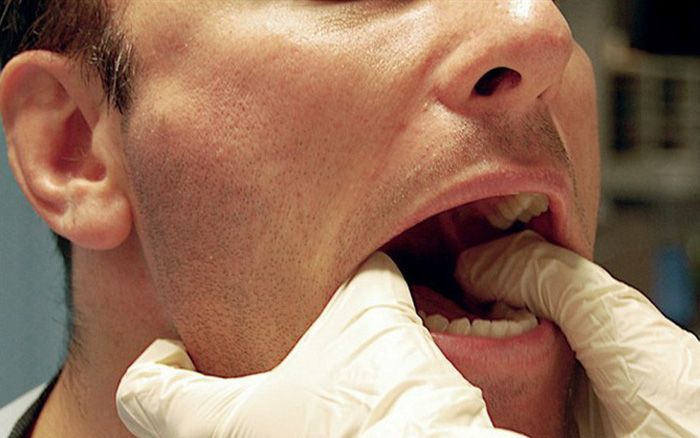 Điểm danh ngay 7 triệu chứng ung thư vòm họng điển hình 