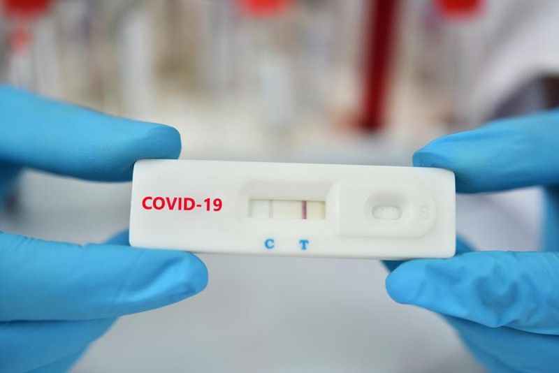 Xét nghiệm nhanh Covid-19 có biết tải lượng virus?